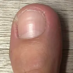 A big toe