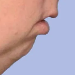 chin