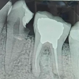 ROOT